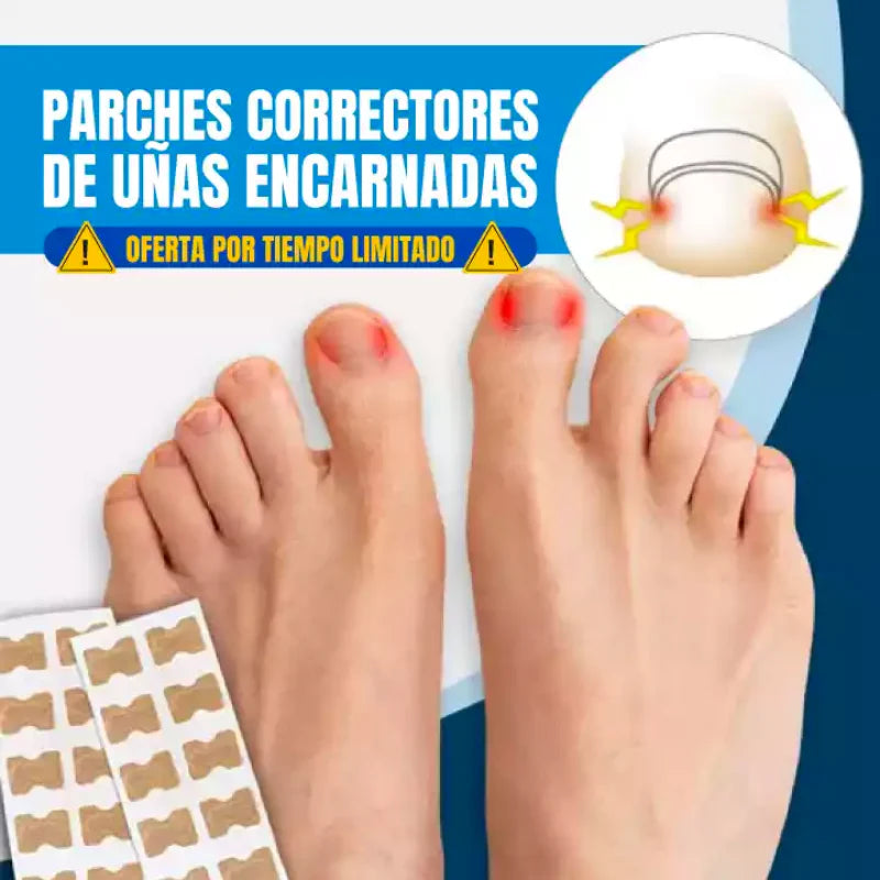 Parches Correctores para Uñas Encarnadas (30 unidades c/caja)