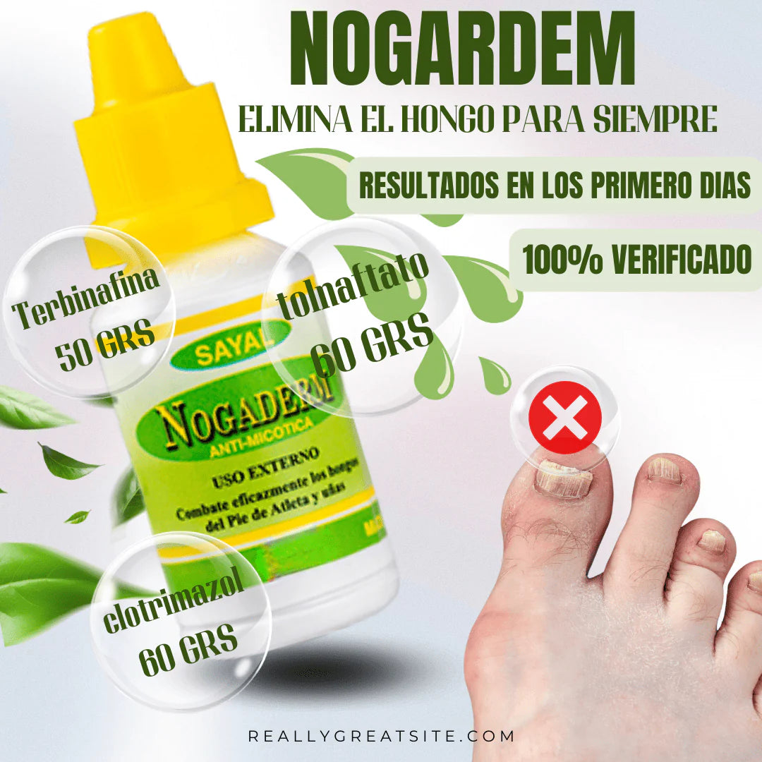 Gotas Antihongo – Fórmula Natural para la Regeneración de Uñas y Piel