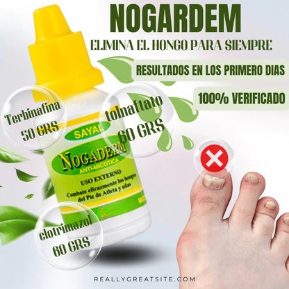 Gotas Antihongo – Fórmula Natural para la Regeneración de Uñas y Piel
