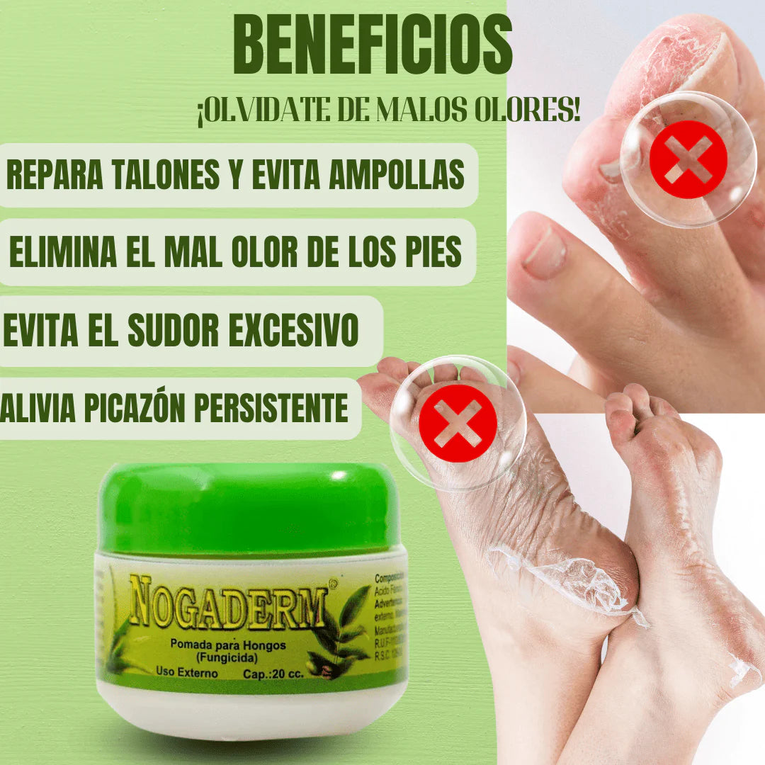 Gotas Antihongo – Fórmula Natural para la Regeneración de Uñas y Piel
