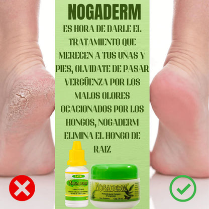 Gotas Antihongo – Fórmula Natural para la Regeneración de Uñas y Piel